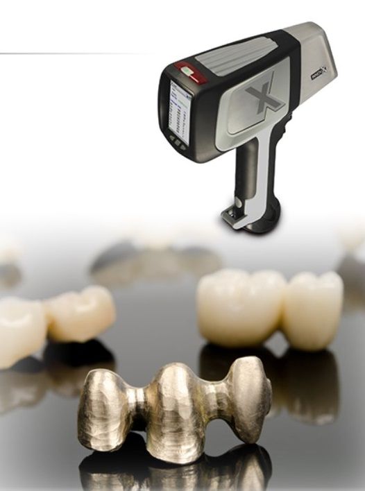 spectrometre, utilisé par Au + pour déterminer la valeur des dents en or rachetées